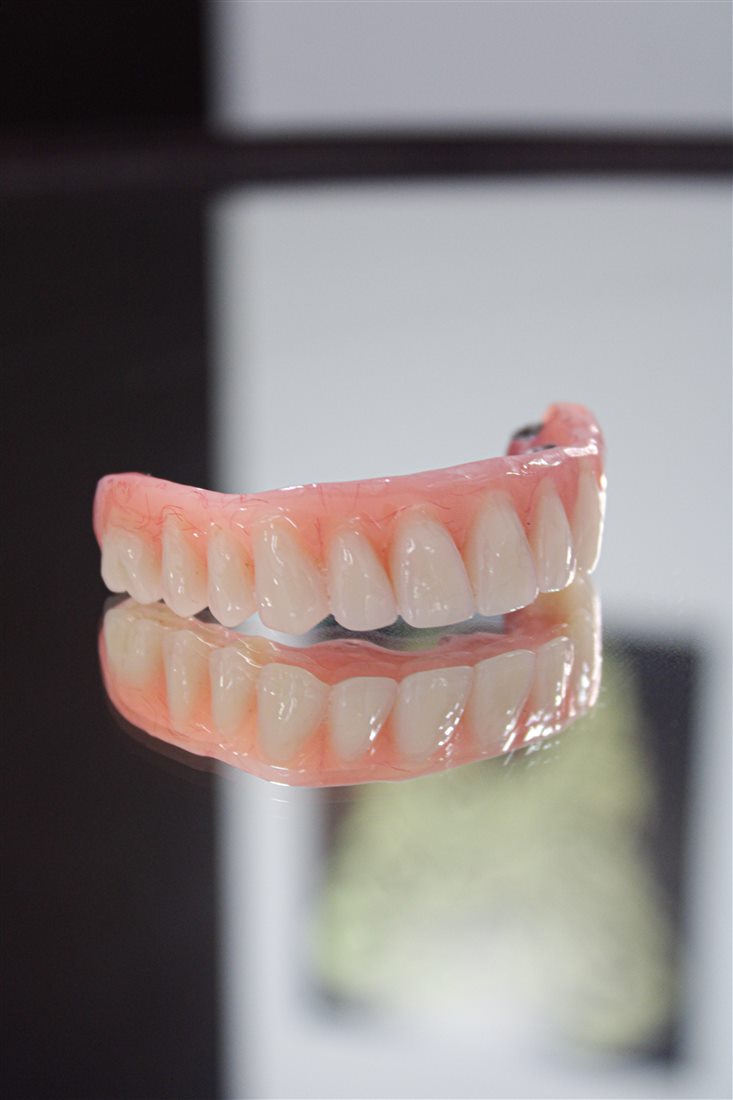 Protocolo fixo — trabalho protético da Vip Sorrisos Prime